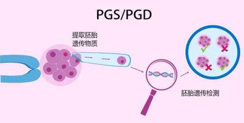 揭秘美国试管ICSI单精子注射技术原理与成功率