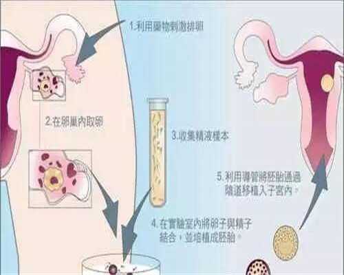 浙江试管婴儿医院选择指南与代生服务解析