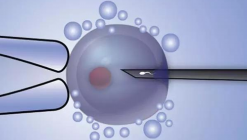 精子库筛选标准与捐精流程详解