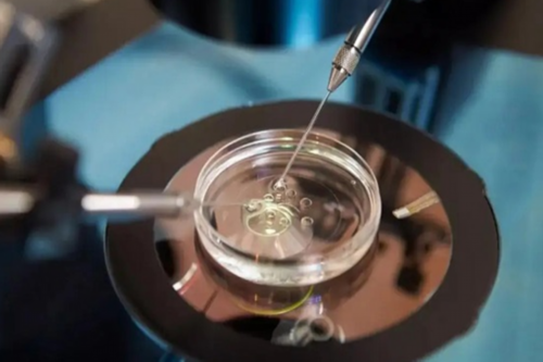 助孕婴儿黄疸高的潜在危害与应对措施