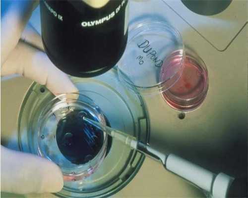 杭州专业供卵中心,杭州做试管婴儿多少钱？有哪些要求？_上海供卵的私立医院