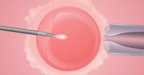 助孕婴儿几天不大便正常吗