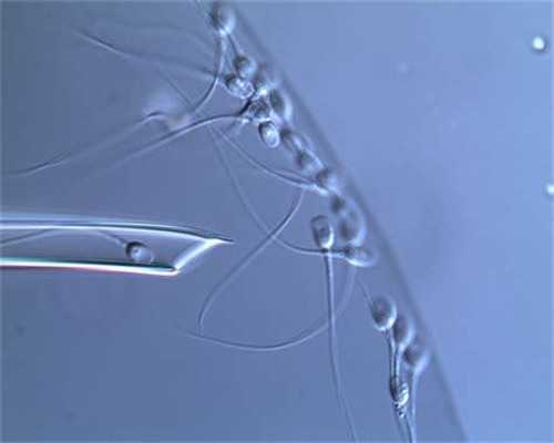 重庆供卵试管产子可靠吗？2026年重庆三代试管生男孩医院排行榜揭晓