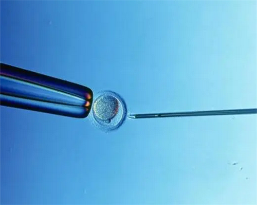 2026浙江第三代试管婴儿选择：嘉兴妇保院与杭州邵逸夫对比指南