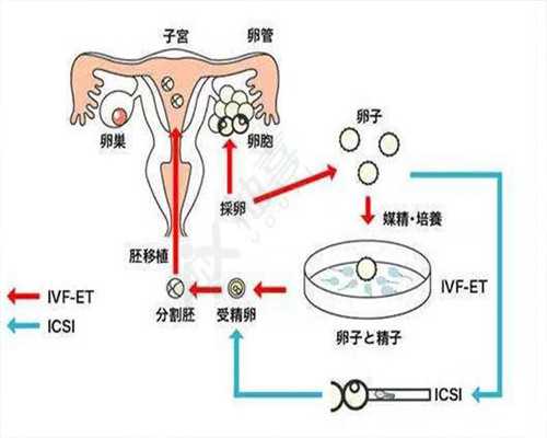 南京试管助孕费用解析与北京三代试管价格参考