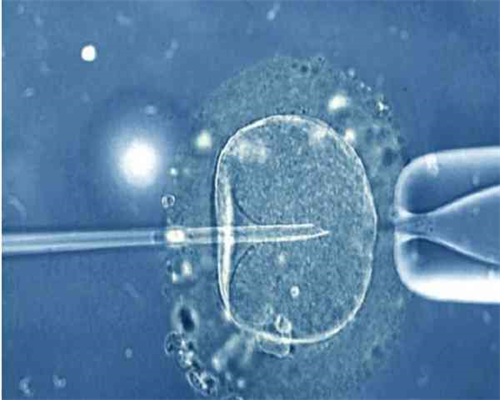 影响试管婴儿费用的关键因素与适应症解析