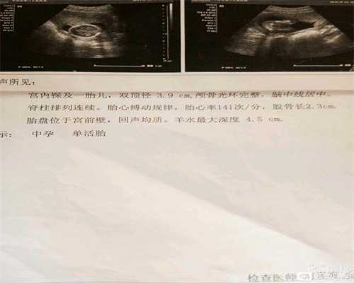 广东省广州代孕公司,子宫内膜薄怎么怀孕西安生