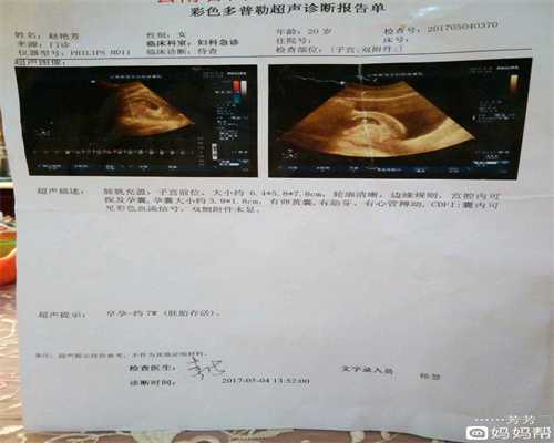 广州供卵生子,怀孕期间哪些因素会影响婴儿的大