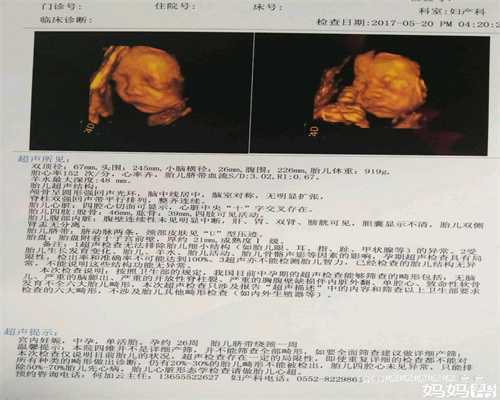 广州代生孩子包成功,怀孕五个月，双胞胎患上罕