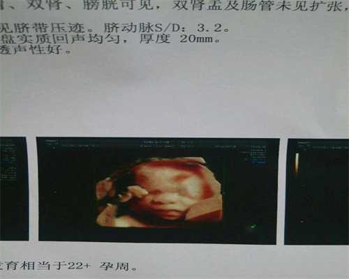 广州代孕双胞胎,怀孕6周孕妇去医院打营养剂，被