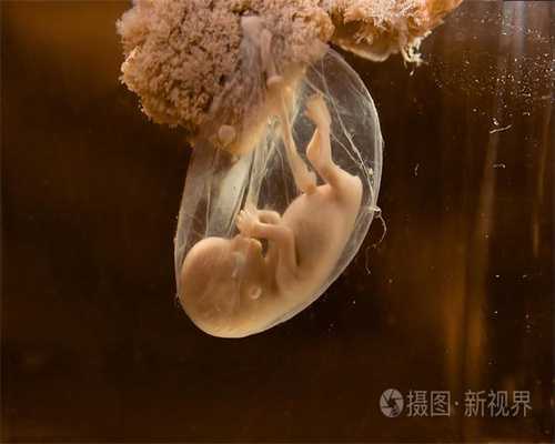 广州代孕最新政策_婴儿头上长了血管瘤