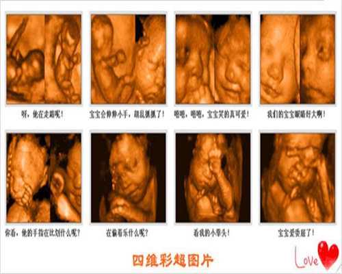 广州代孕价格大约多少_胎盘位于子宫底壁