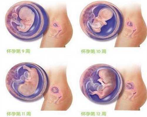 广州代孕中介价格_冬季产后坐月子如何护理乳房