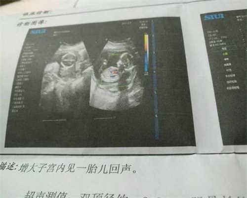 广州正规医院代孕孩子_羊水，你想知道的七个疑