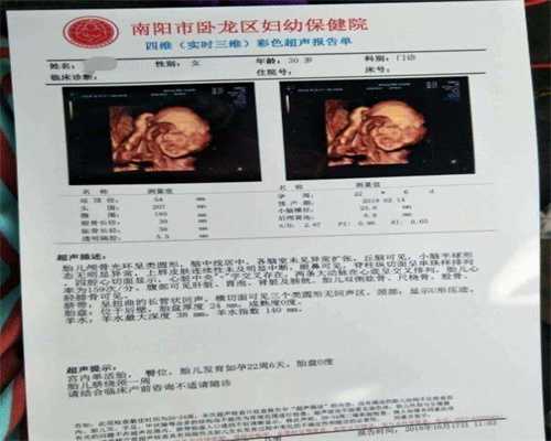 广州代孕公司哪里成功率高_胎动和胎儿健康