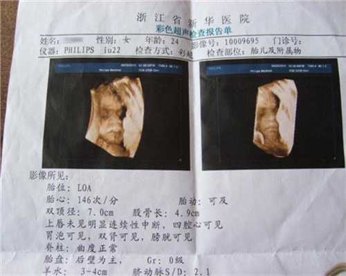 广州代孕公司哪里成功率高_胎动和胎儿健康