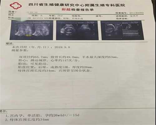 广州代孕专业机构_胎儿胎心率低怎么回事