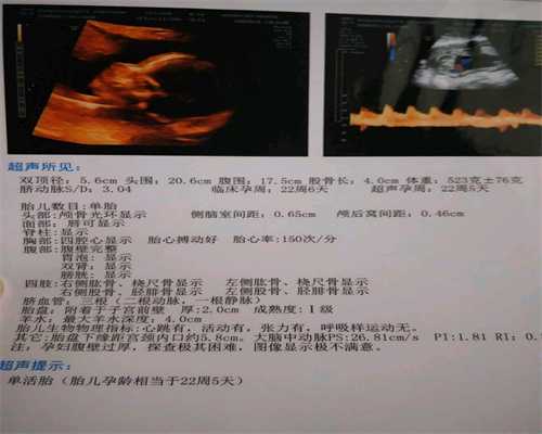 广州找代孕去那找_剖宫产后伤口为什么会痒痒的？