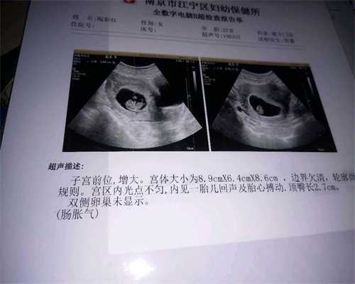 代怀孕2020价格广州_广州代孕产子的过程和方式