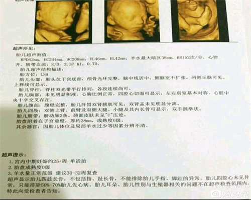 天津广东代怀孕公司_天津国内代孕的公司有哪些