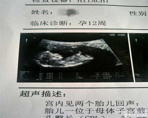 广州代孕合法的国家有哪些_广州代孕公司需要多少钱