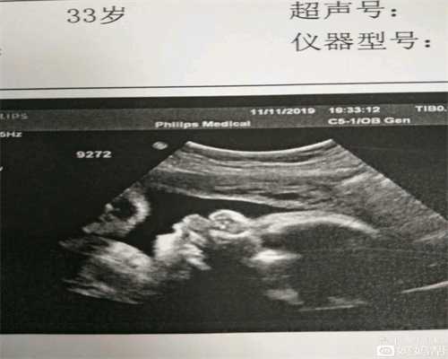 广州代生小孩过程_自判怀孕困难的5个征兆