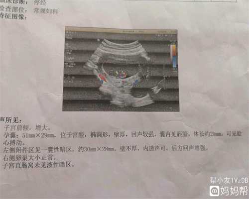 广州代生双胞胎网_腹壁子宫内膜异位症有什么危害