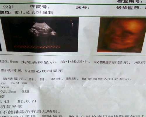 广州代孕婴儿~广州做人工受孕~2020年广州借卵生子的费用