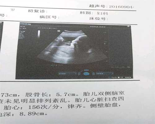 广州靠谱代孕，广州代孕哪家强，广州代怀孕价格qq群