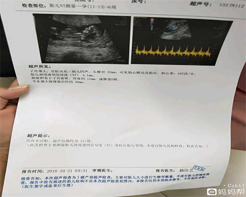 广州代孕网,广州做代孕哪家好,广州借卵生子年龄有限制吗