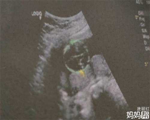 广州代孕网址~广州代孕是怎样代的~做人流2次还可以怀孕吗