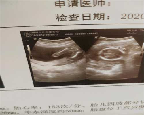 广州代孕集团,广州做试管的医院,怀孕初期平躺好吗