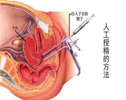 广州试管以后不能生育-4岁宝宝口服脊灰疫苗致残案例是流言吗？