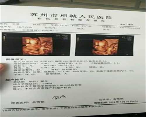 广州代生靠谱吗-孕妈的末次月经日期如何算出预产期？