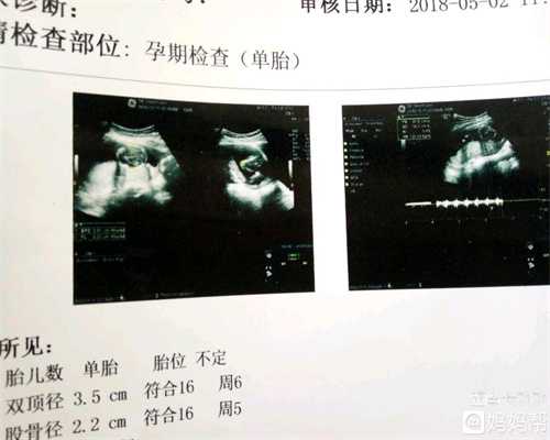 广州代孕包性别多少钱：广州代怀孕中心_广州代孕生孩子多少钱