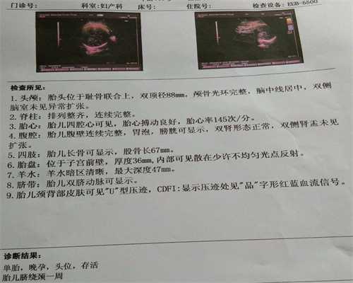 广州国外代孕费用：广州代怀生男孩宝宝_广州代孕的价格