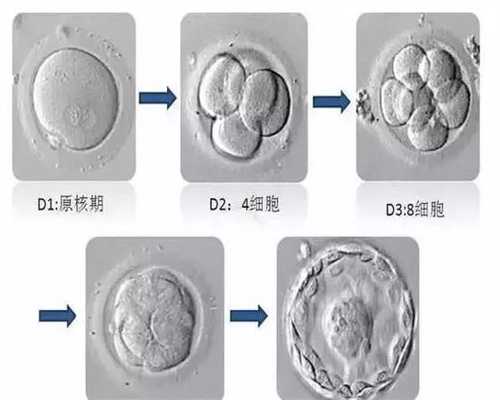 代孕费用便宜吗-广州有供卵的生殖中心_试管婴儿反复失败是胚胎的原因吗？
