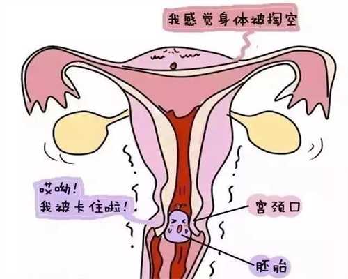 广州供卵流程需要多久-哪里有供卵机构_澳门试管_澳门有哪些排名靠前的试管婴