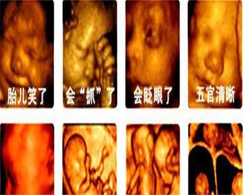 国家正规的代孕公司-广州借腹生子生殖中心选性别_辽阳可以做试管婴儿吗？这