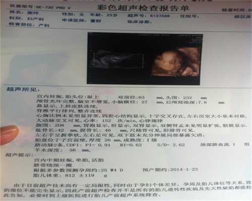 代孕费用的行情-广州代孕程序_上海第三代试管婴儿哪里成功率比较高呢？去哪