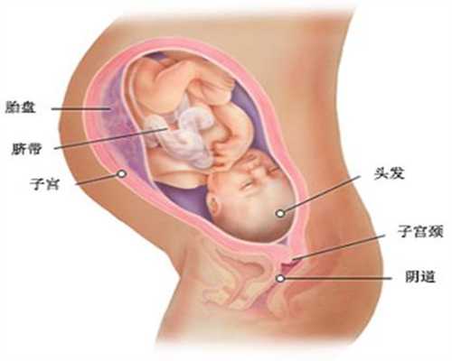 如何去找代孕-广州代孕怎么选择性别_做泰国试管婴儿有年龄的限制吗？