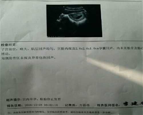 广州代孕哪家比较可靠-有愿意代孕的吗_试管婴儿降调期间需要注意什么？