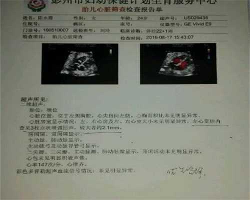 广州公立医院供卵要求-代孕生子费用价格_柬埔寨第三代试管婴儿全流程详解
