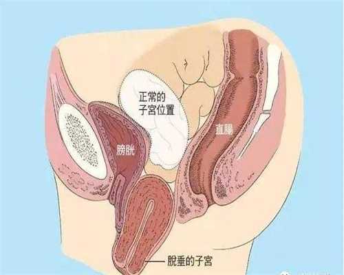 代孕移植一个月怎么办-广州艾滋病患者代孕_2021做试管详细流程！