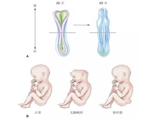在做代孕是个什么感受-广州代孕产子中心哪家好_水蛭治子宫肌瘤特效是真的吗
