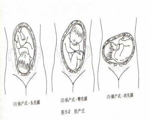 供卵试管的费用多少呢-广州代孕生儿子价格_输卵管囊肿能做试管婴儿助孕吗