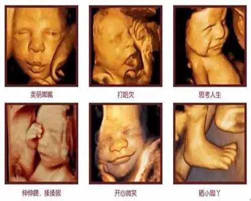 女性结扎能代孕吗-广州代孕孩子可以嘛_潍坊妇幼保健院试管婴儿怎么样？配合