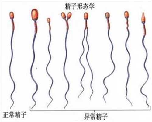 广州代孕怎么选择性别-找个女人代孕要多少费用_第二代试管婴儿长大后的弊端