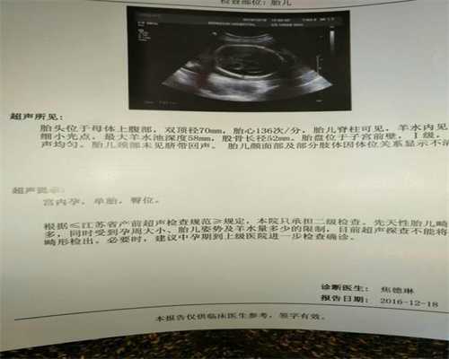 广州2022代孕孩子-哪里可以做代孕生小孩_国内助孕机构&amp;2021广州借卵试管最全