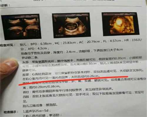 广州南方代孕-代孕包成功合法不_美国试管婴儿常见的促排卵疑问解答！